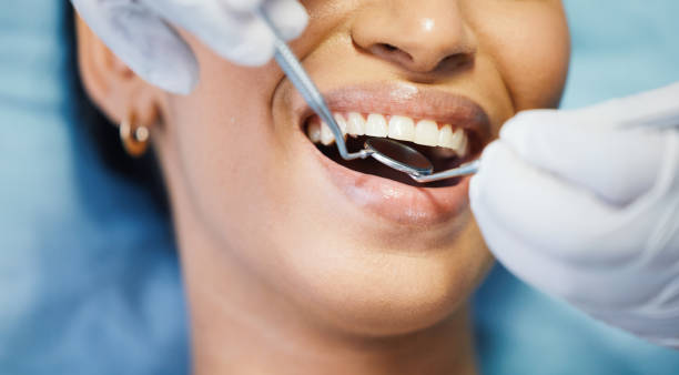 Best Broken or Chipped Tooth Repair in Fullerton, PA