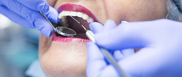 Best Knocked-Out Tooth (Avulsed Tooth) Treatment in Fullerton, PA